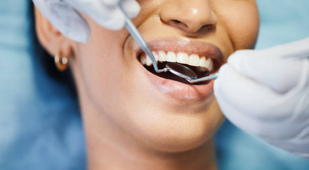 Best Emergency Dental Care for Trauma or Injury in Seattle, WA