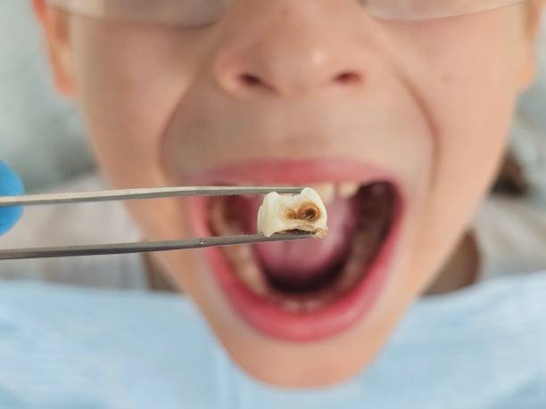 Best Pediatric Emergency Dentist in Seattle, WA